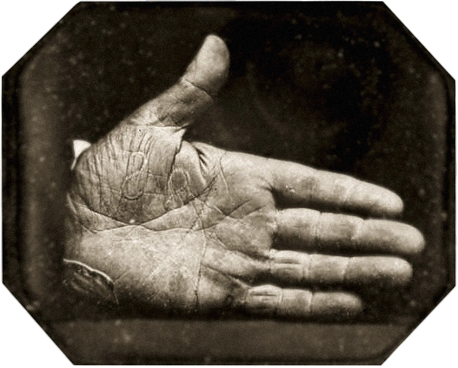 Johanthan Walker’s right hand with “SS” branded onto the palm.